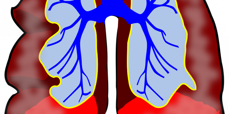 Bronchitis Burial Insurance